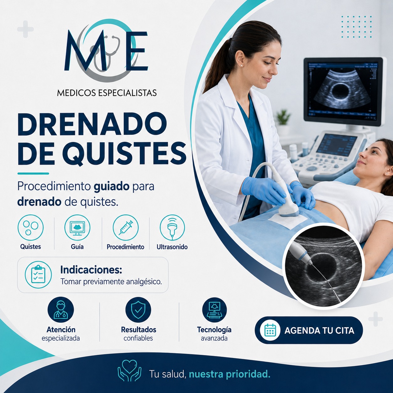 Drenado de quistes