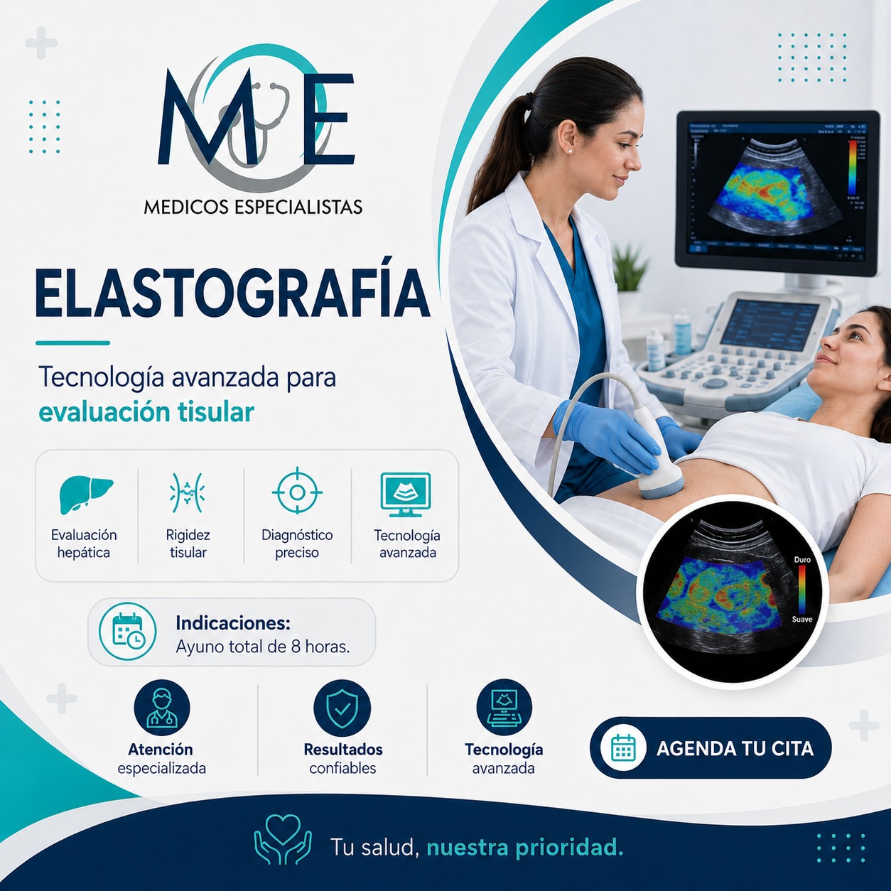 Elastografía