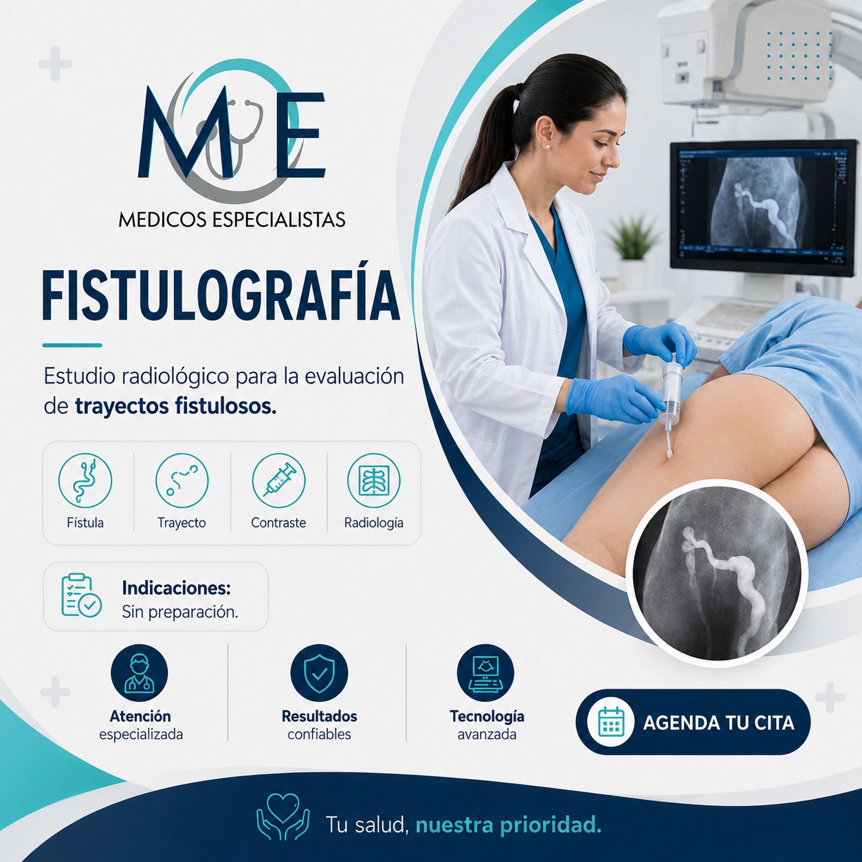 Fistulografía