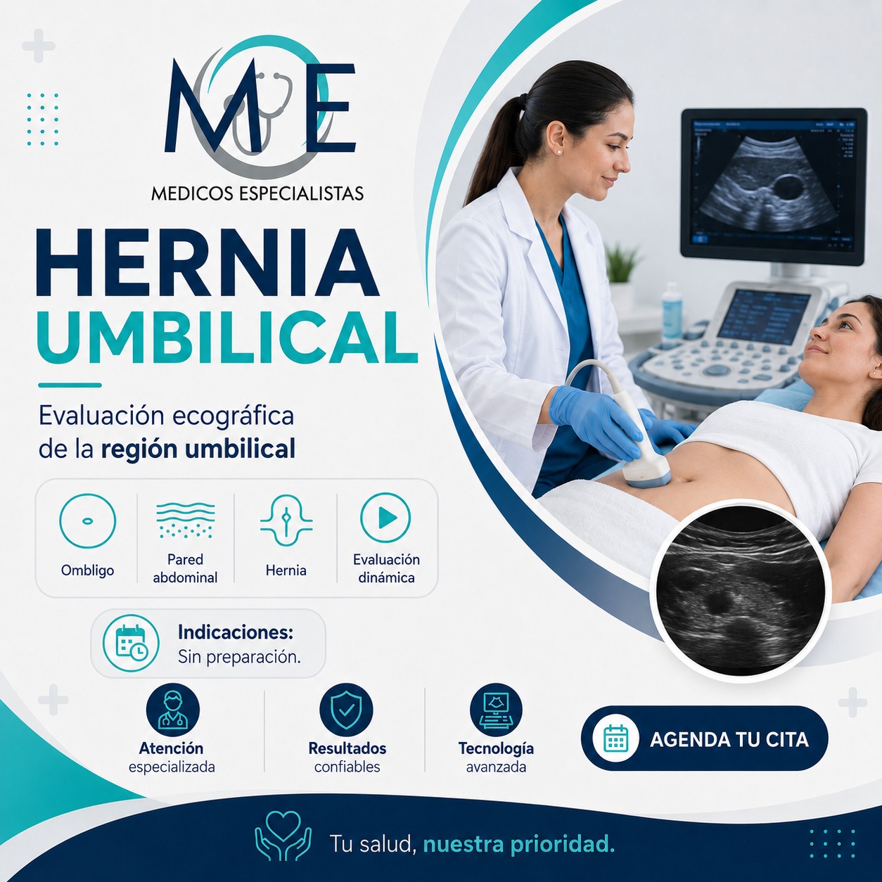 Hernia Umbilical
