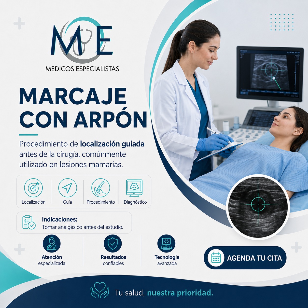 Marcaje con Arpón